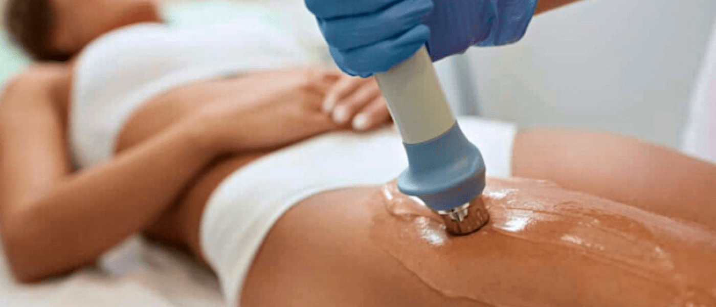 cellulite treatment acoustic wave therapy the villages florida